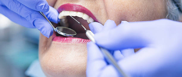 Best Broken or Chipped Tooth Repair in Brownfields, LA